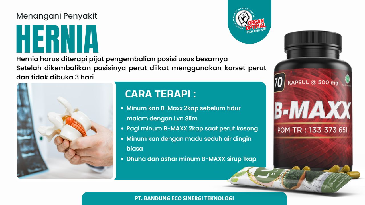 Slide4
